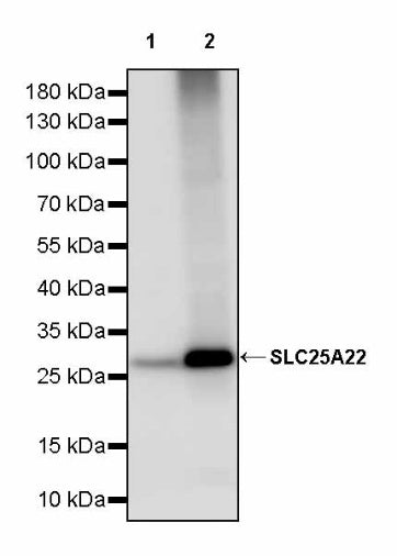 SLC25A22 Recombinant Rabbit mAb (S-2780-15)