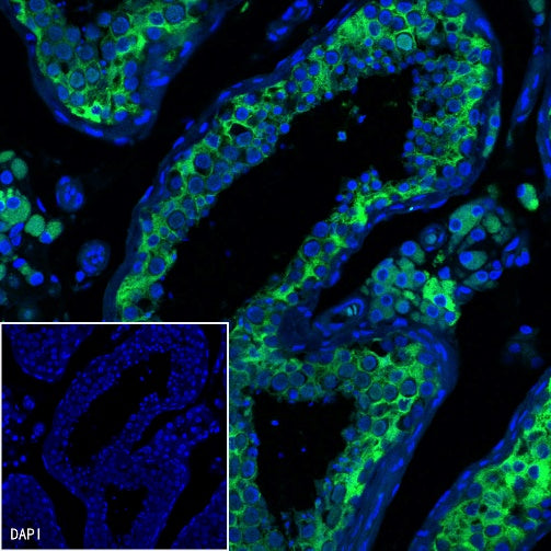 Inhibin alpha Recombinant Rabbit mAb (SDT-R307)