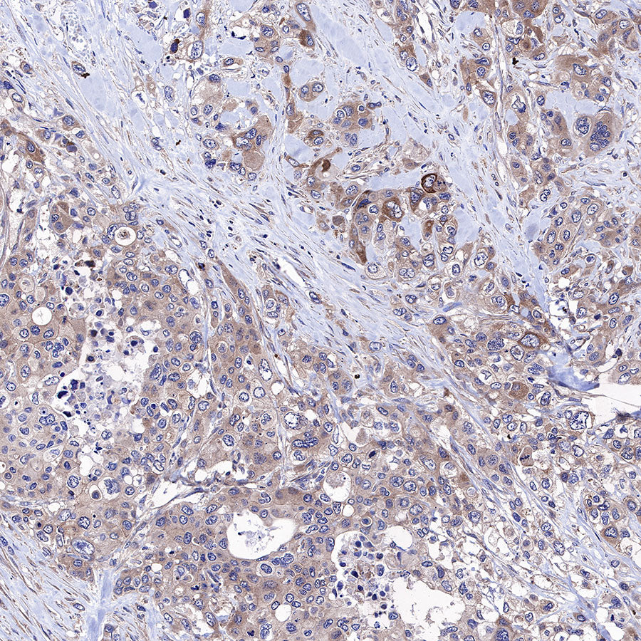 AMPKα Recombinant Rabbit mAb (S-455-38)