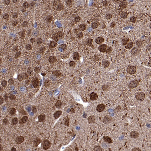 UCHL1 Rabbit Polyclonal Antibody
