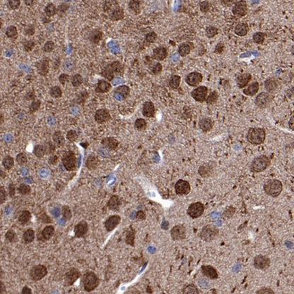 UCHL1 Rabbit Polyclonal Antibody