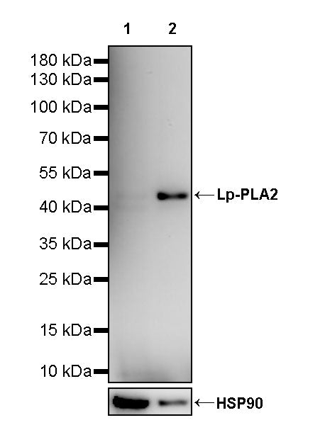 Lp-PLA2 Recombinant Rabbit mAb (S-3711-113)
