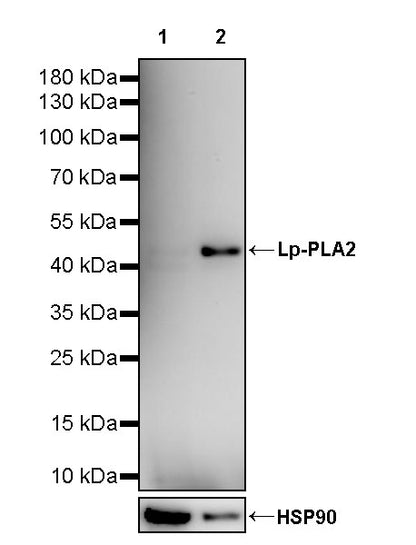 Lp-PLA2 Recombinant Rabbit mAb (S-3711-113)
