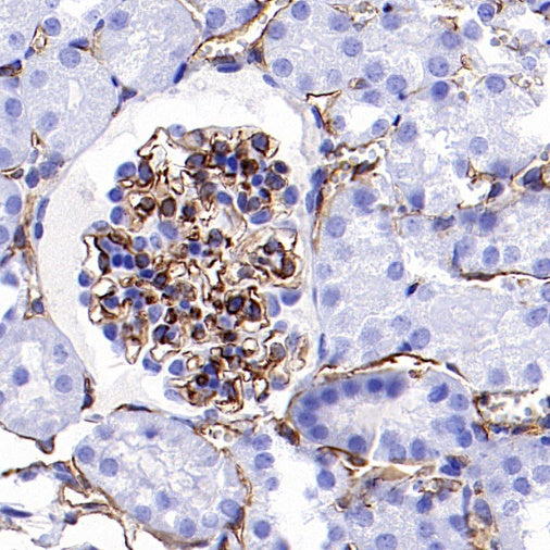 CD31 Recombinant Rabbit mAb (S-R568)