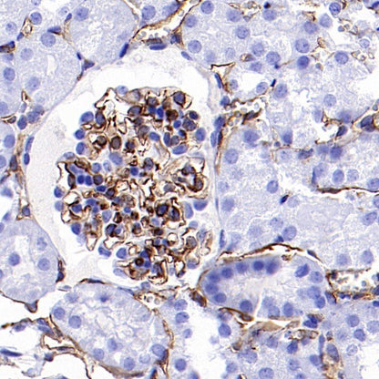 CD31 Recombinant Rabbit mAb (S-R568)