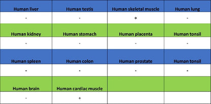 MYH7 Recombinant Rabbit mAb (SDT-2936-44)