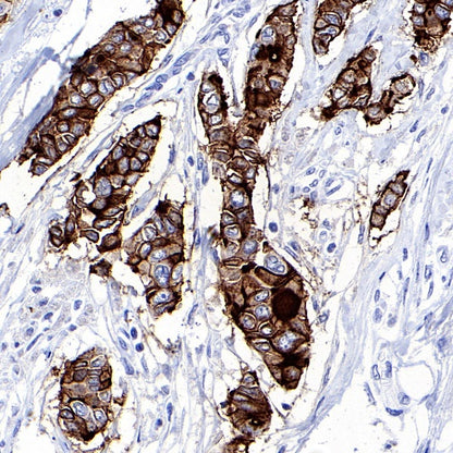 MUC1/EMA Mouse mAb (SDT-777-37)