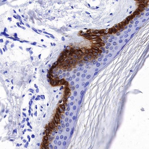 Collagen XVII Recombinant Rabbit mAb (S-1636-5)