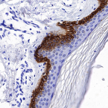 Collagen XVII Recombinant Rabbit mAb (S-1636-5)