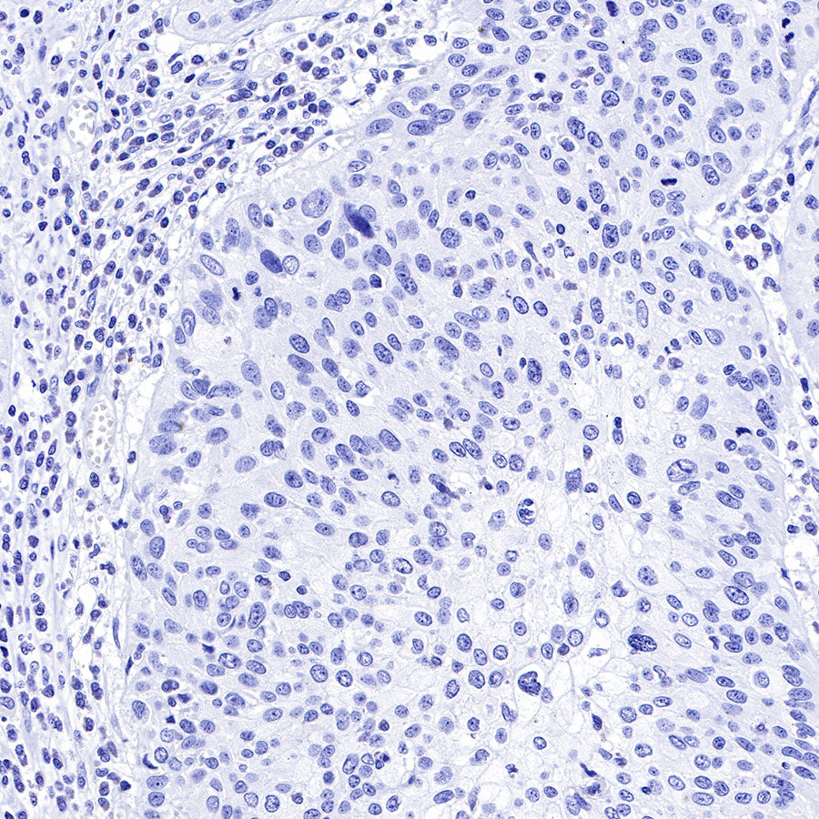 OCT3/4 Recombinant Rabbit mAb (SDT-165-76)