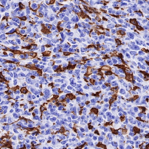 CD163 Recombinant Rabbit mAb (SDT-222-171)