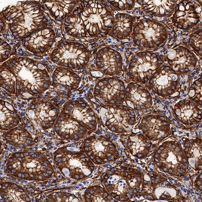 S-RMab®Annexin A2 Recombinant Rabbit mAb (SDT-444-67)