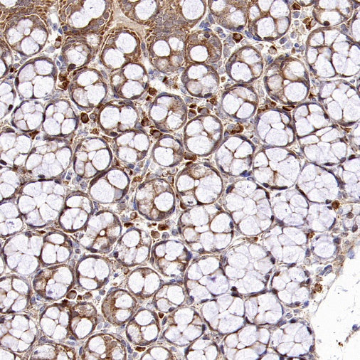 Mitofusin 2 Recombinant Rabbit mAb (S-1783-49)