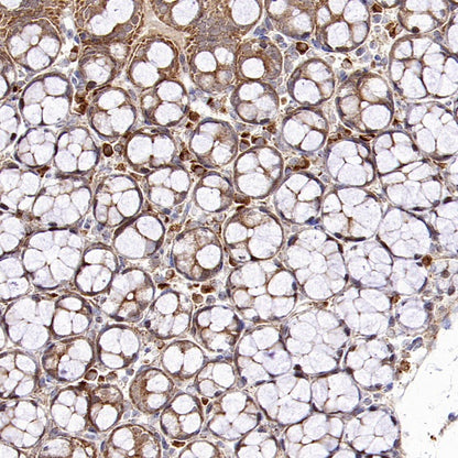 Mitofusin 2 Recombinant Rabbit mAb (S-1783-49)