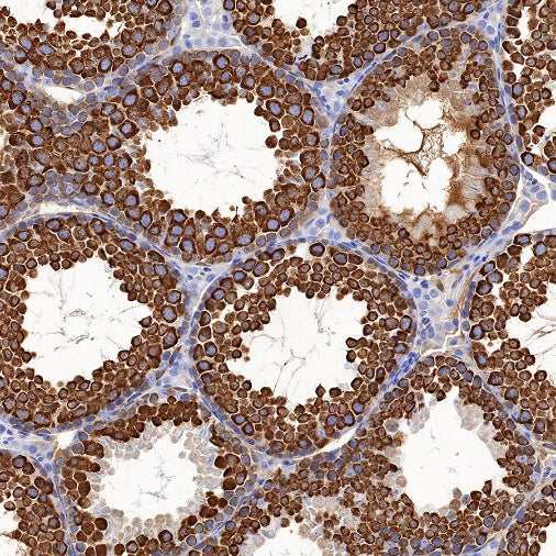 DDX4 Recombinant Rabbit mAb (S-1570-48)