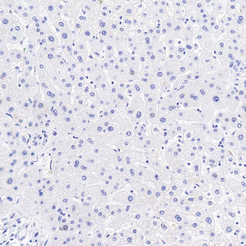 FGF-19 Recombinant Rabbit mAb (SDT-1070-17)