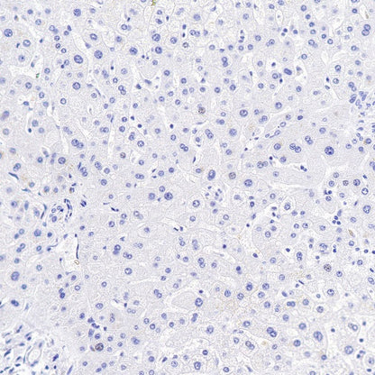 FGF-19 Recombinant Rabbit mAb (SDT-1070-17)
