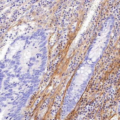Periostin Recombinant Rabbit mAb (S-2824-17)