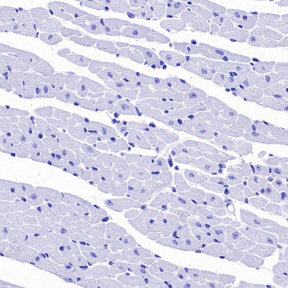 Ly6G Recombinant Rabbit mAb (S-2495-6)