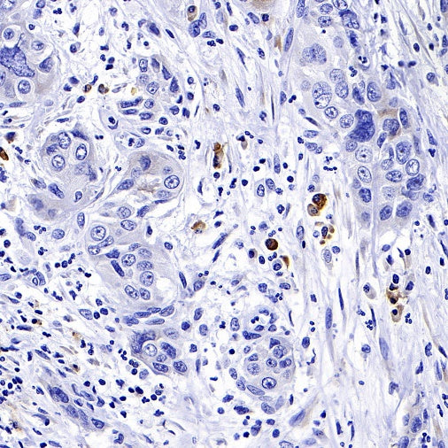 CXCR3 Recombinant Rabbit mAb (S-377-8)