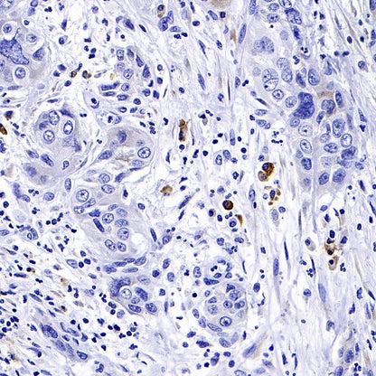 CXCR3 Recombinant Rabbit mAb (S-377-8)