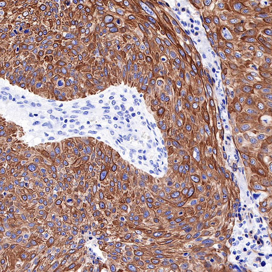 Keratin 17 Recombinant Rabbit mAb (SDT-011-43)