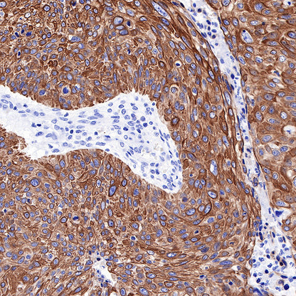 Keratin 17 Recombinant Rabbit mAb (SDT-011-43)
