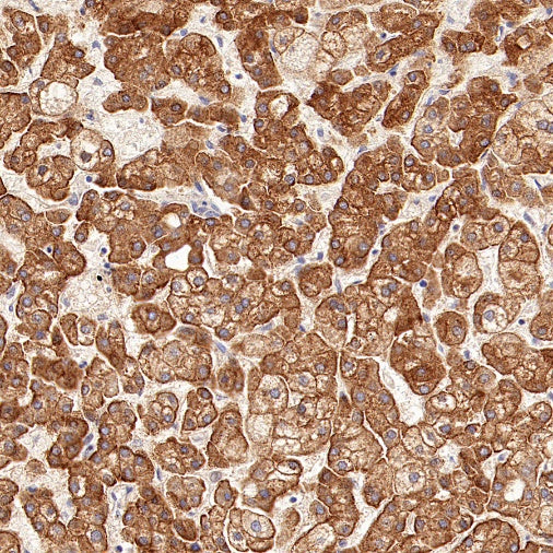 Transferrin Receptor 2/TFR2 Recombinant Rabbit mAb (S-1735-133)