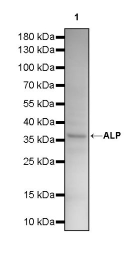 ALP Recombinant Rabbit mAb (S-2786-41)