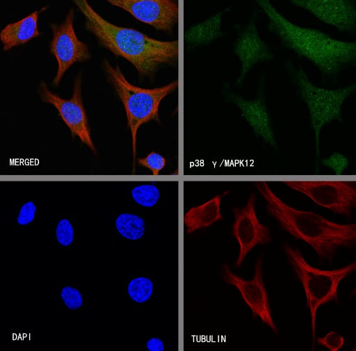 p38 gamma/MAPK12 Recombinant Rabbit mAb (S-1253-50)