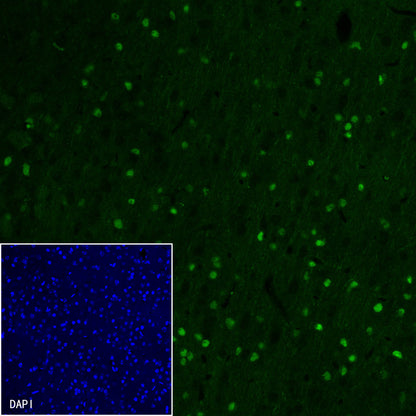 Olig2 Recombinant Rabbit mAb (SDT-648-155)