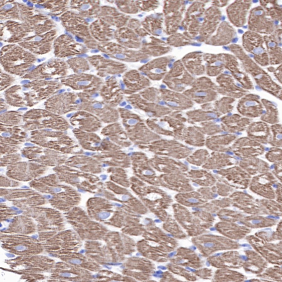 alpha-actinin-2 Recombinant Rabbit mAb (SDT-032-79)