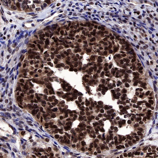 MGMT Recombinant Rabbit mAb (SDT-522-71)