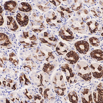 MUC5AC Recombinant Rabbit mAb, PBS Only (SDT-2630-23)
