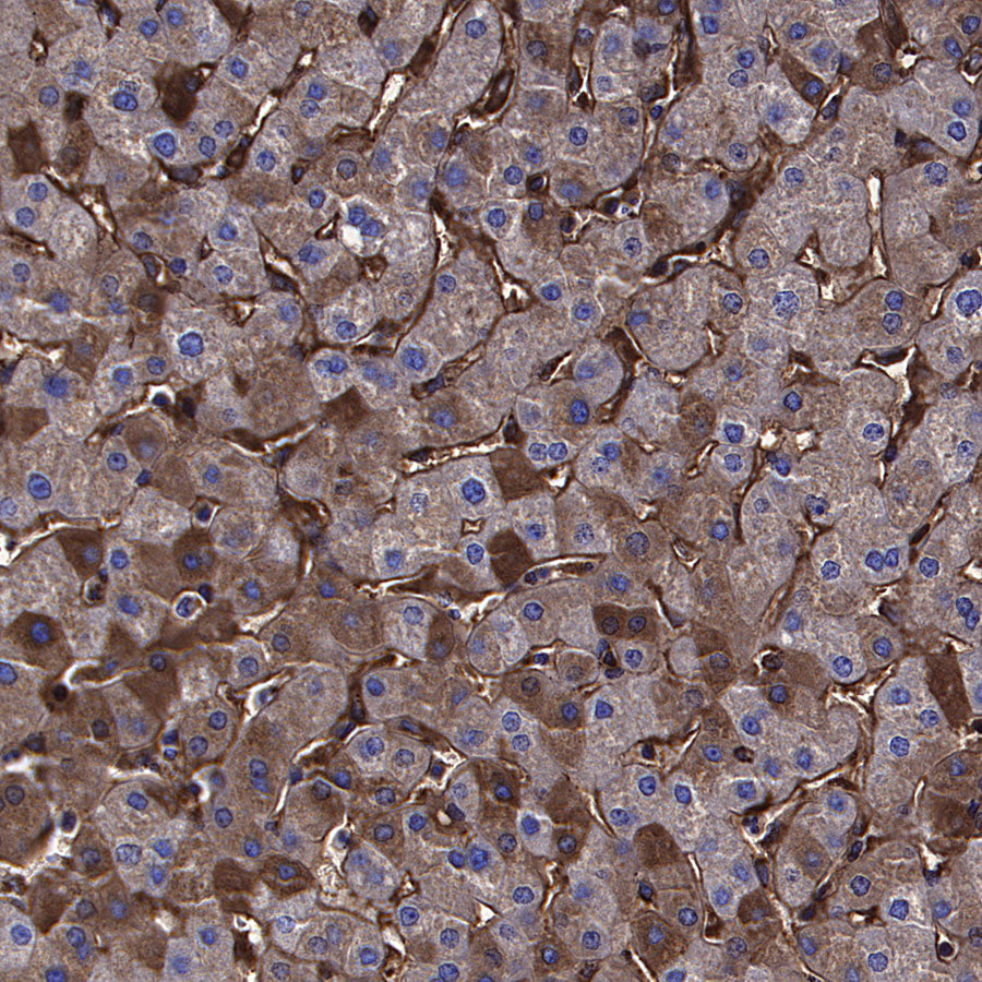 Choline Kinase α/CHKA Recombinant Rabbit mAb (S-4422-31)