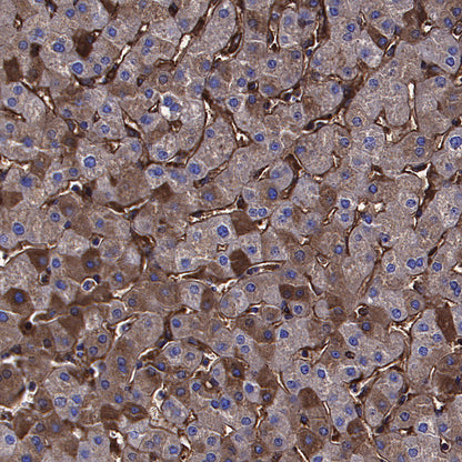 Choline Kinase α/CHKA Recombinant Rabbit mAb (S-4422-31)