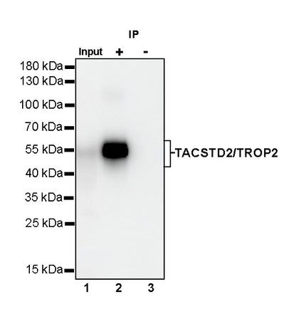 TACSTD2/TROP2 Recombinant Rabbit mAb (S-R238)