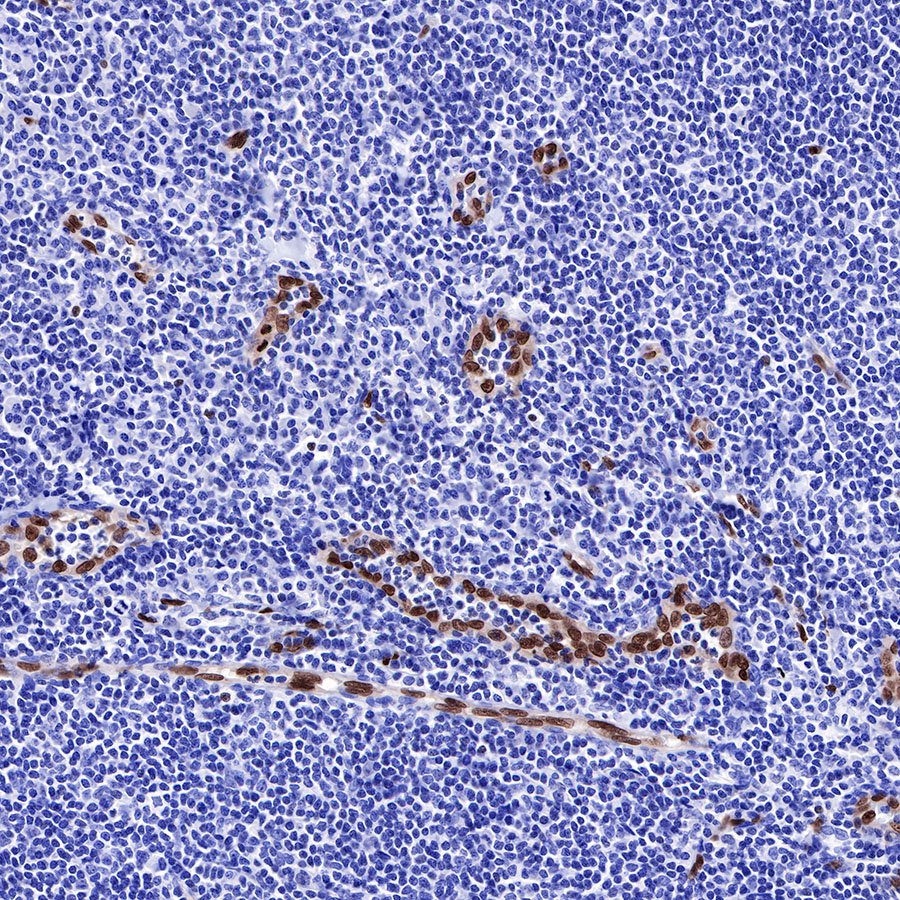 ERG Recombinant Rabbit mAb,PBS Only (SDT-190-65)