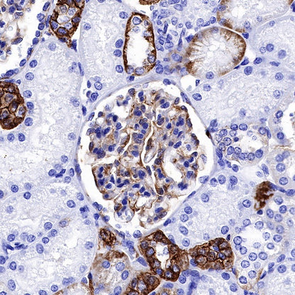 NDRG1 Recombinant Rabbit mAb (S-623-82)