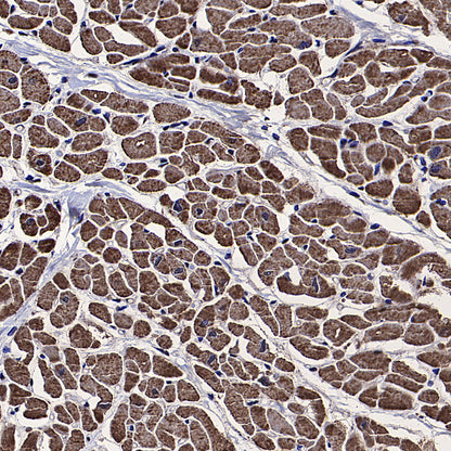PDHE1 Alpha Mouse mAb