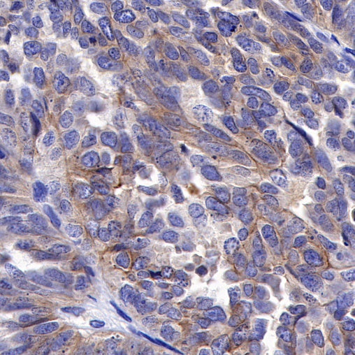 ROR1 Recombinant Rabbit mAb (SDT-R502-2)