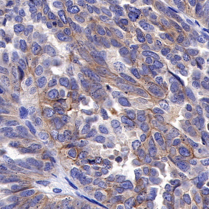 ROR1 Recombinant Rabbit mAb (SDT-R502-2)