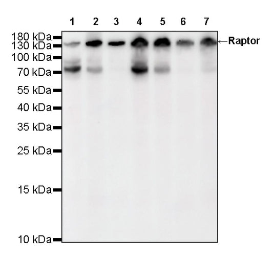 Raptor Recombinant Rabbit mAb (S-5325)