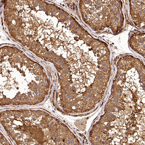 PFKL+PFKM Recombinant Rabbit mAb (S-1302-31)