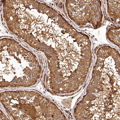 PFKL+PFKM Recombinant Rabbit mAb (S-1302-31)