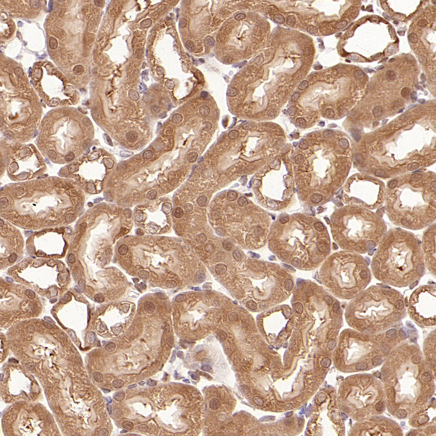 S-RMab® GAPDH Recombinant Rabbit mAb (S-240-147)