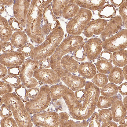 S-RMab® GAPDH Recombinant Rabbit mAb (S-240-147)