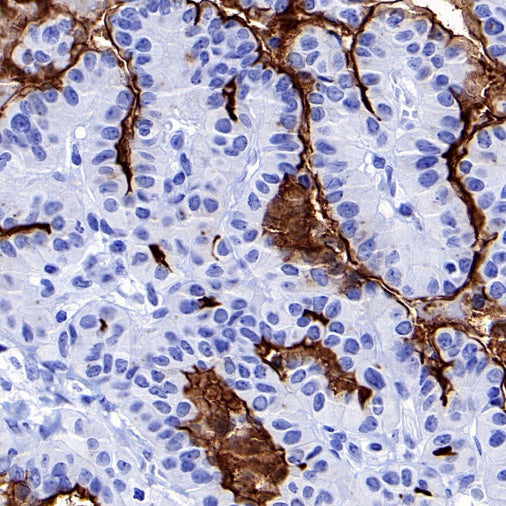 MUC1/EMA Mouse mAb (SDT-777-37)
