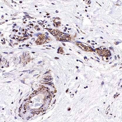 Fumarate hydratase Recombinant Rabbit mAb (SDT-2434-54)