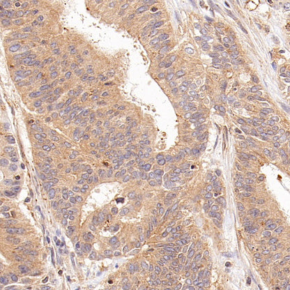 RhoA Recombinant Rabbit mAb (S-1310-159)